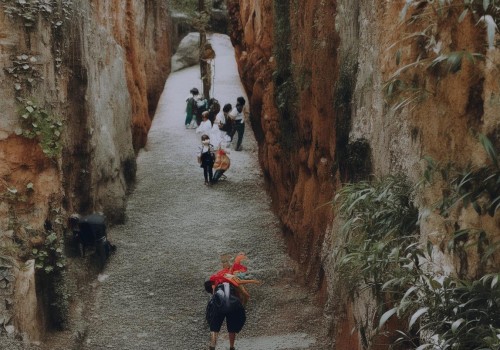 眼部手术，重塑视界的关键之旅
