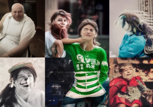 好,我现在需要帮用户写一篇关于儿童眼整形的文章。首先,我得理解用户的需求。用户可能是一位自媒体作者,需要一篇不少于875字的文章,标题和内容都要写出来。标题要吸引人,内容要详细且有深度 好,我现在需要帮用户写一篇关于儿童眼整形的文章。首先,我得理解用户的需求。用户可能是一位自媒体作者,需要一篇不少于875字的文章,标题和内容都要写出来。标题要吸引人,内容要详细且有深度