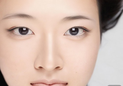 无痕双眼皮是一种美容手术方法，旨在通过手术或非手术的方式改善眼部外貌，使眼睛更加美观和有神。无痕双眼皮主要包括埋线法和微创手术法