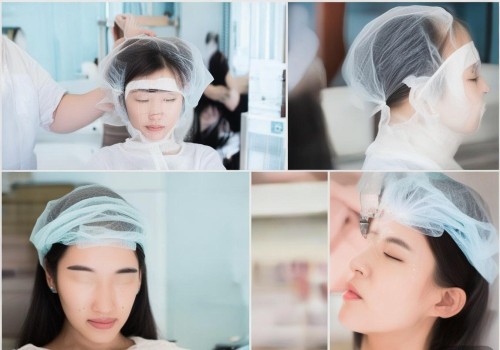 微创眼整形,从选择到恢复的全过程 微创眼整形,从选择到恢复的全过程