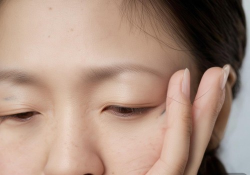 嗯，用户问的是双眼皮术后闭眼不全正常吗？首先，我需要理解用户的问题。他们可能刚刚做完双眼皮手术，发现闭眼的时候眼皮没有完全闭上，担心这是不是正常的，或者是不是哪里做错了